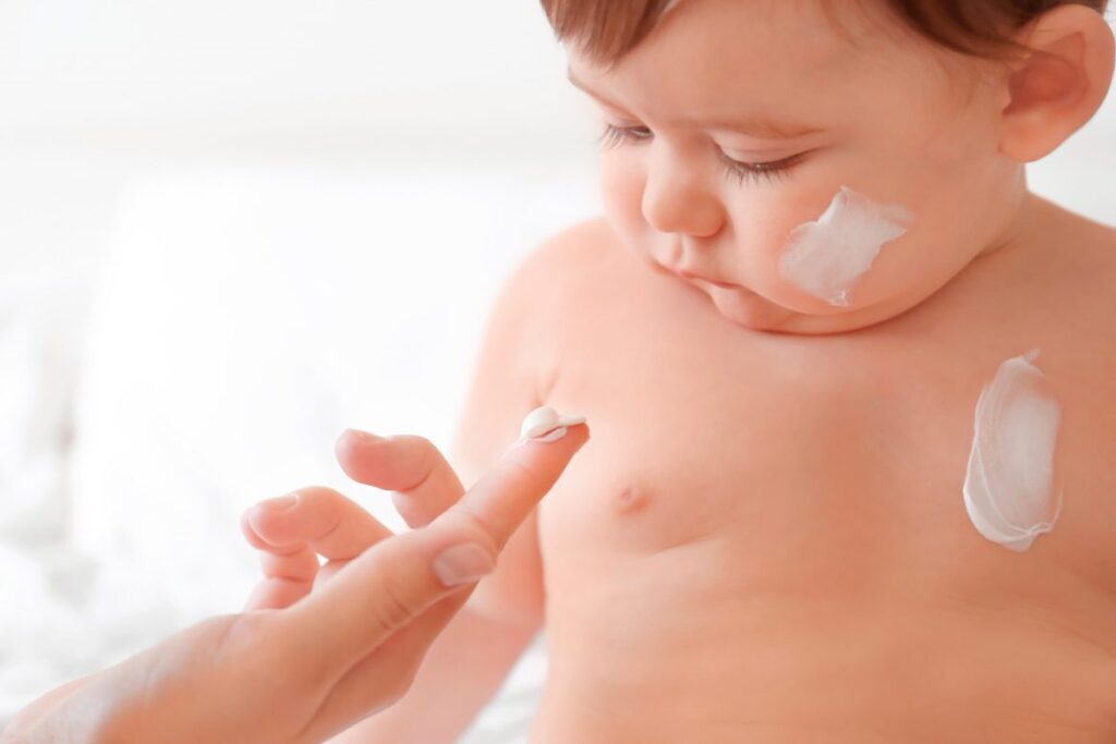 dermatitis-atopica-infantil-1170x780-1-1024x683-5601405